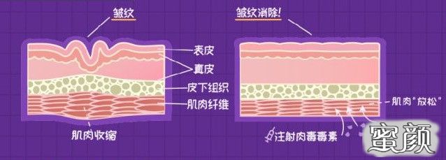 案例图片