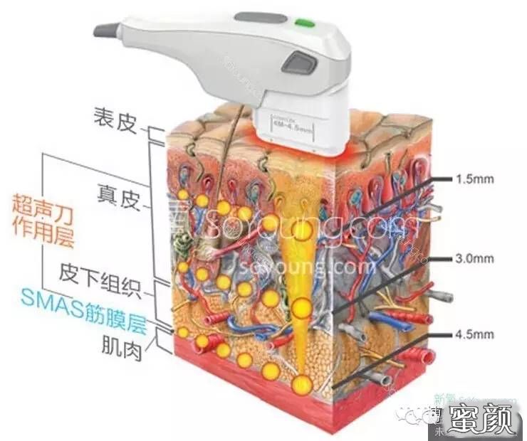 案例图片