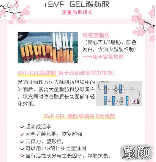 https://img.miyanlife.com/mnt/timg/210205/160124J26-3.jpg