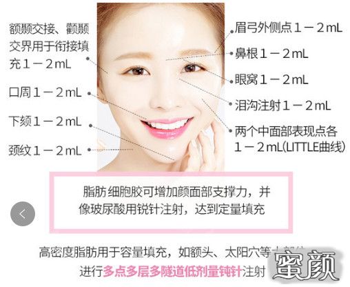 https://img.miyanlife.com/mnt/timg/210205/160130C52-5.jpg