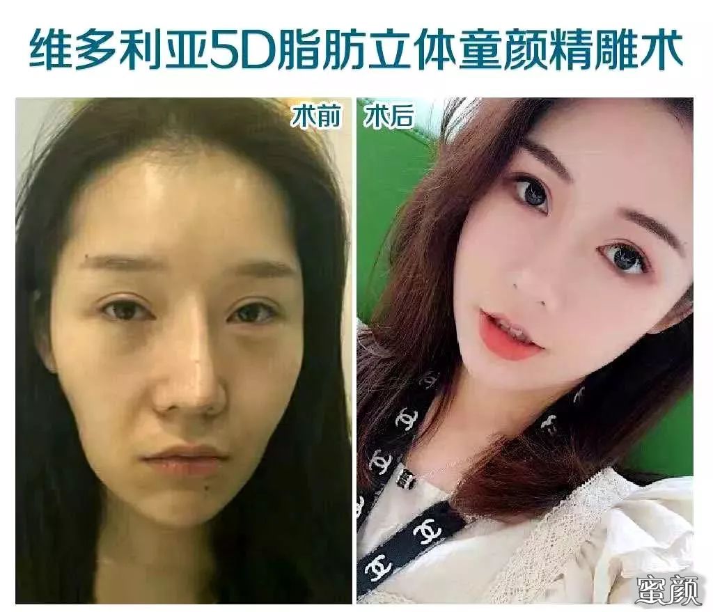 https://img.miyanlife.com/mnt/timg/210210/1135005H4-5.jpg