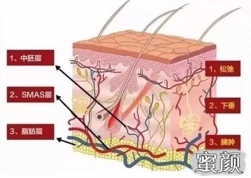 案例图片