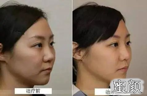 https://img.miyanlife.com/mnt/timg/210219/1FF61426-7.jpg