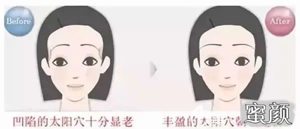https://img.miyanlife.com/mnt/timg/210221/164U41529-0.jpg
