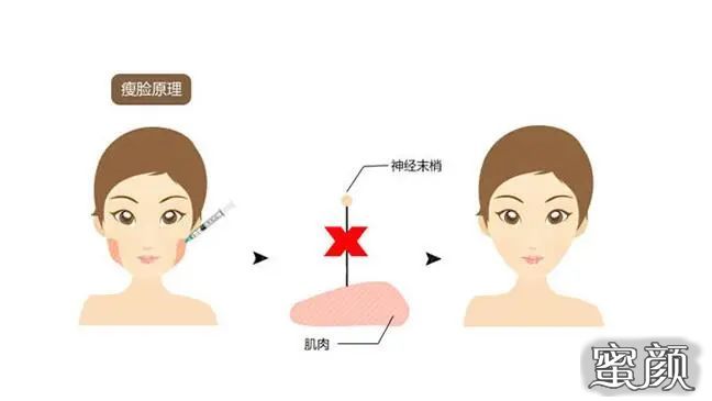 https://img.miyanlife.com/mnt/timg/210226/195944L92-2.jpg