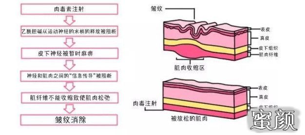 https://img.miyanlife.com/mnt/timg/210226/19595aV4-6.jpg
