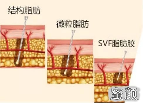 案例图片