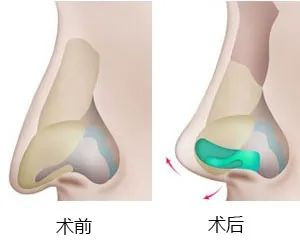 案例图片