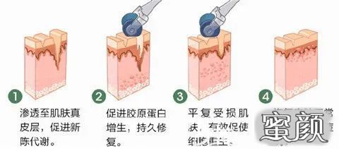 https://img.miyanlife.com/mnt/timg/210303/21203G413-2.jpg