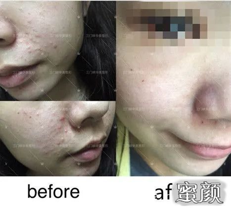 https://img.miyanlife.com/mnt/timg/210303/21203HD1-4.jpg