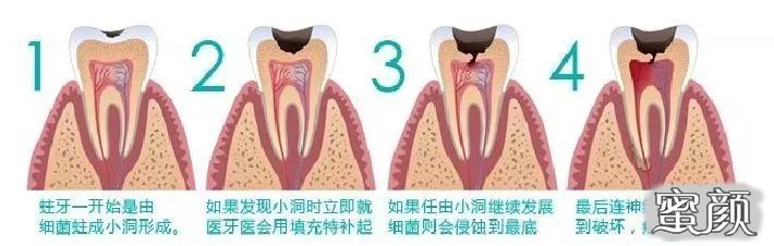 案例图片