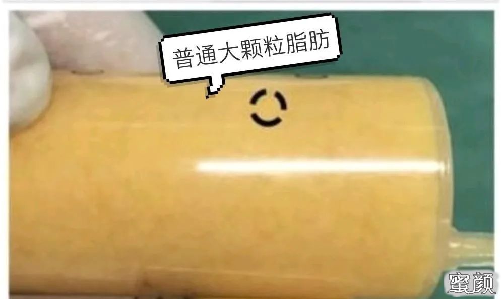 https://img.miyanlife.com/mnt/timg/210304/22193TP2-4.jpg