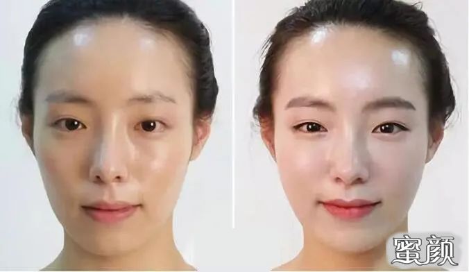 https://img.miyanlife.com/mnt/timg/210304/2219434329-11.jpg