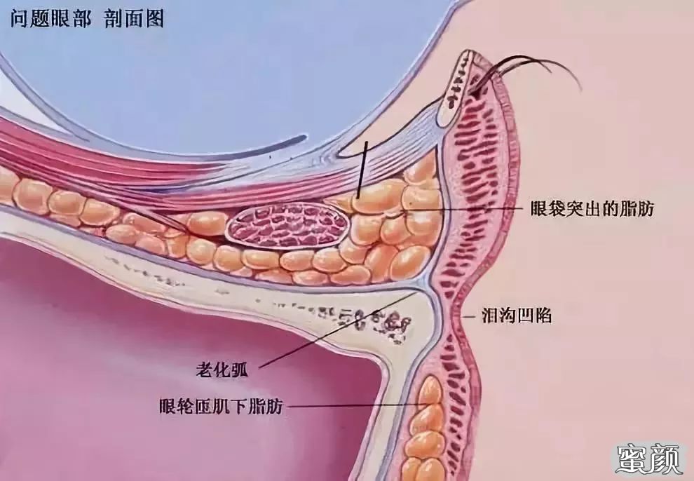 案例图片