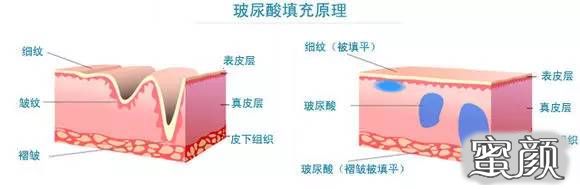 https://img.miyanlife.com/mnt/timg/210306/2043463595-2.jpg