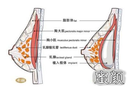 案例图片