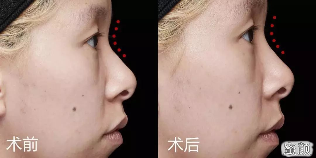 https://img.miyanlife.com/mnt/timg/210309/120F33451-4.jpg