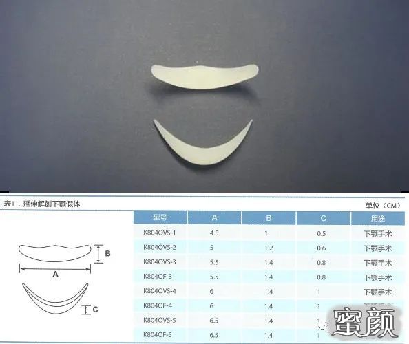 案例图片