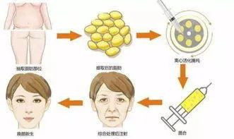 https://img.miyanlife.com/mnt/timg/210311/1230152060-6.jpg
