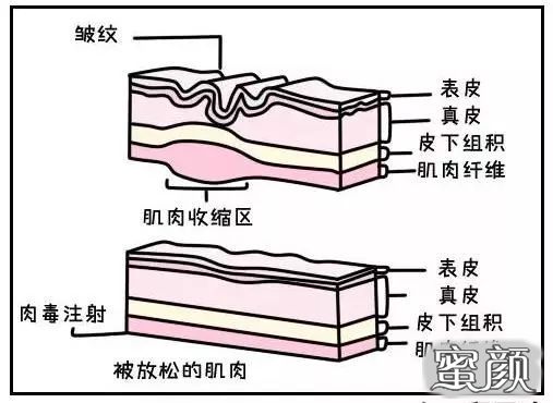 案例图片