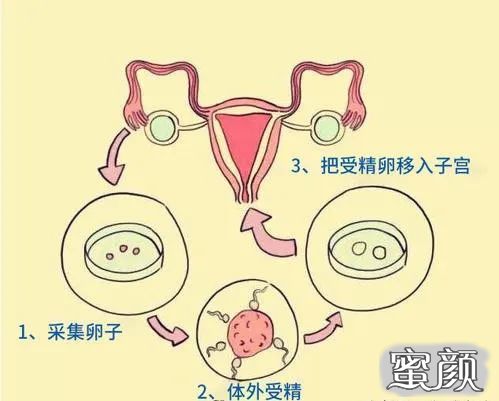 案例图片