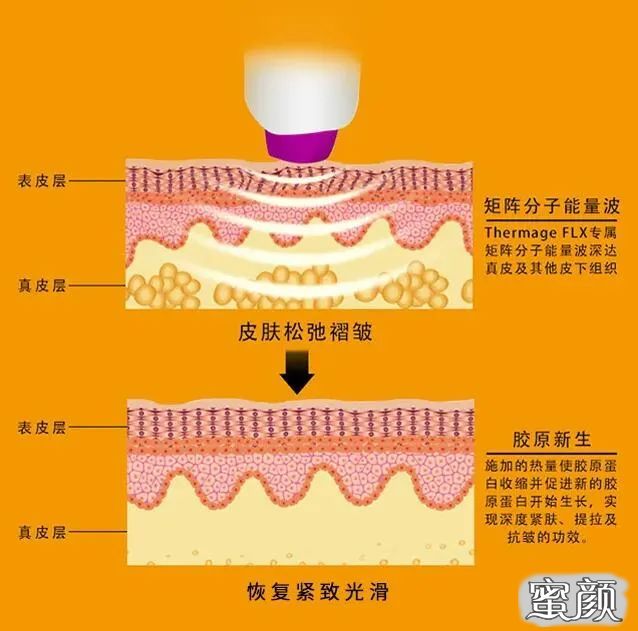 https://img.miyanlife.com/mnt/timg/210318/2000263A3-0.jpg