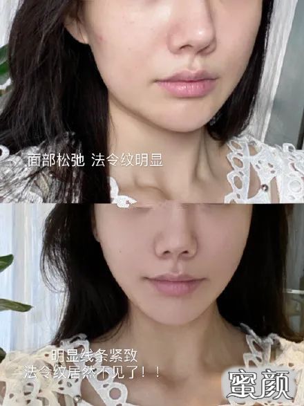 https://img.miyanlife.com/mnt/timg/210318/20022CU5-7.jpg