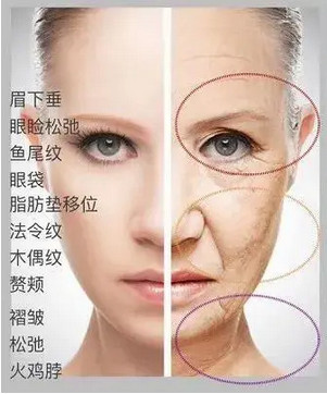 https://img.miyanlife.com/mnt/timg/210319/16161451F-0.jpg
