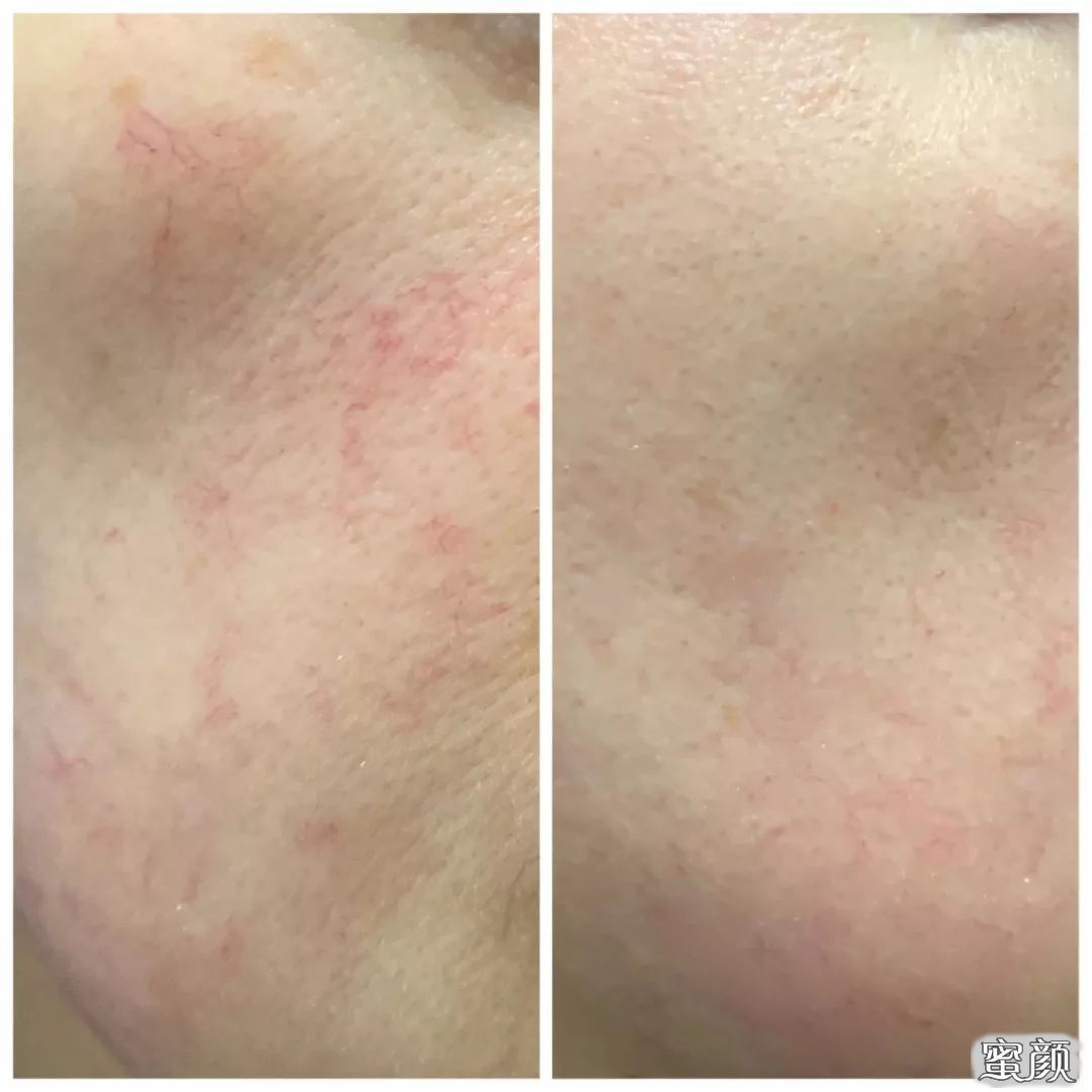 https://img.miyanlife.com/mnt/timg/210320/204U43V4-4.jpg