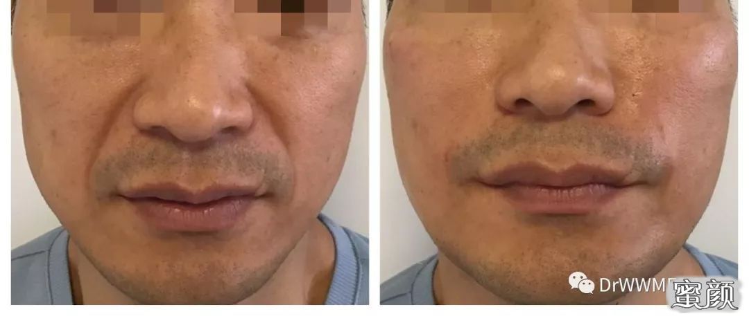 https://img.miyanlife.com/mnt/timg/210321/1322062B1-3.jpg