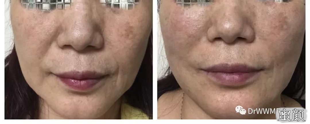https://img.miyanlife.com/mnt/timg/210321/13220JR4-6.jpg