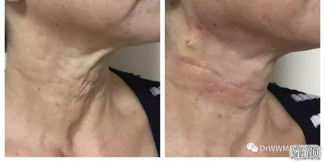 https://img.miyanlife.com/mnt/timg/210321/132210M31-12.jpg
