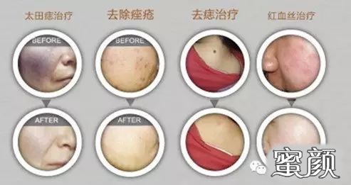 https://img.miyanlife.com/mnt/timg/210321/1H6403120-1.jpg