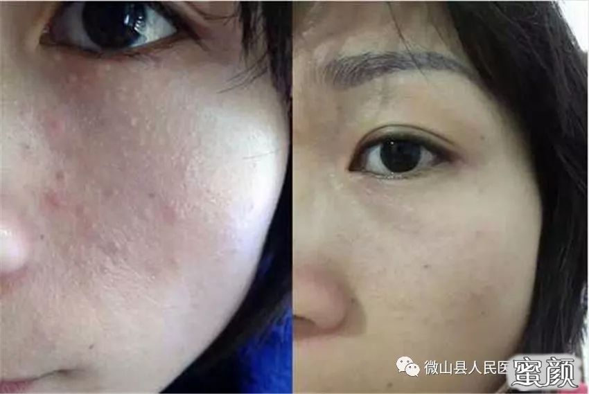 https://img.miyanlife.com/mnt/timg/210321/2134446414-2.jpg