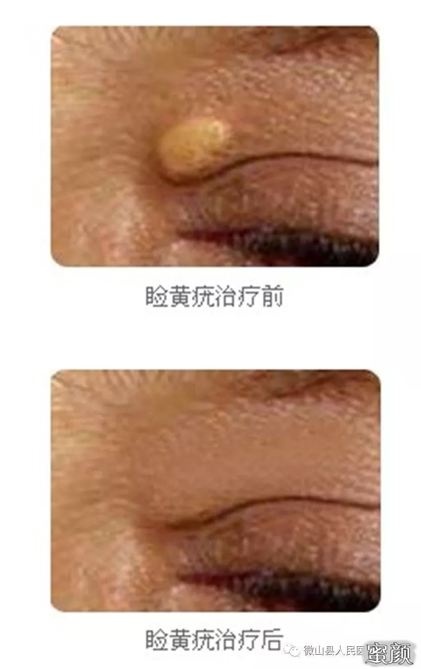https://img.miyanlife.com/mnt/timg/210321/2134451J3-3.jpg