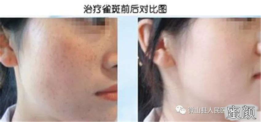 https://img.miyanlife.com/mnt/timg/210321/2134461631-5.jpg