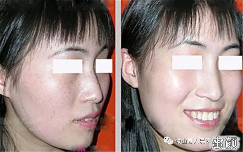 https://img.miyanlife.com/mnt/timg/210321/2134462F2-6.jpg