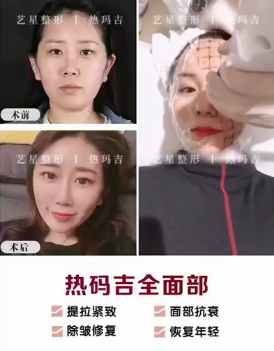 https://img.miyanlife.com/mnt/timg/210322/2015251629-4.jpg