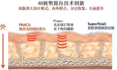 案例图片