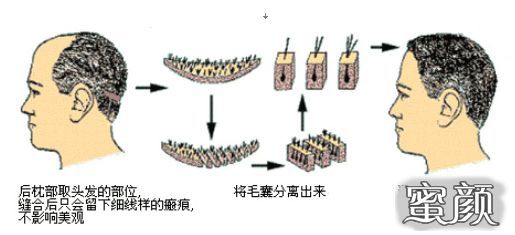 案例图片