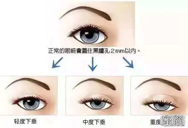 https://img.miyanlife.com/mnt/timg/210325/1242491391-10.jpg