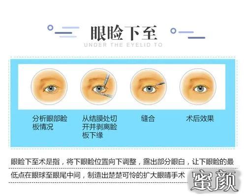 https://img.miyanlife.com/mnt/timg/210325/1242491429-12.jpg