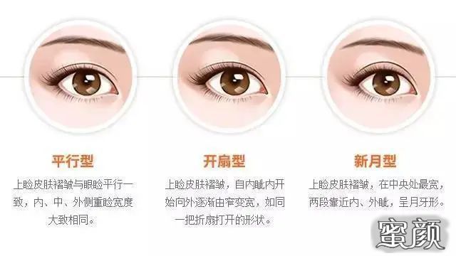 https://img.miyanlife.com/mnt/timg/210325/12424A2Y-0.jpg