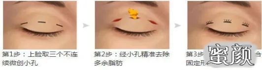 https://img.miyanlife.com/mnt/timg/210325/12424I041-3.jpg