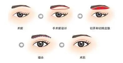 https://img.miyanlife.com/mnt/timg/210325/12424LF4-4.jpg
