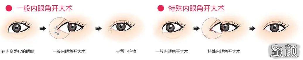 https://img.miyanlife.com/mnt/timg/210325/12424ME1-5.jpg