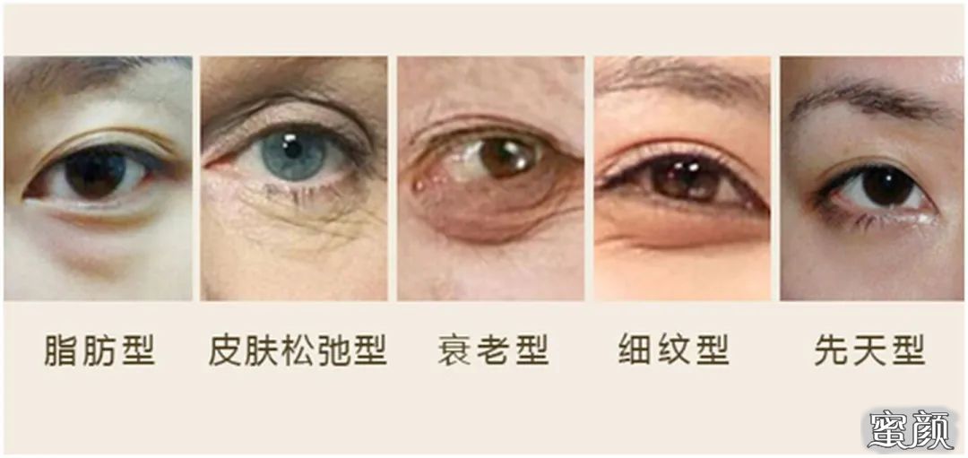 https://img.miyanlife.com/mnt/timg/210325/12424R314-6.jpg
