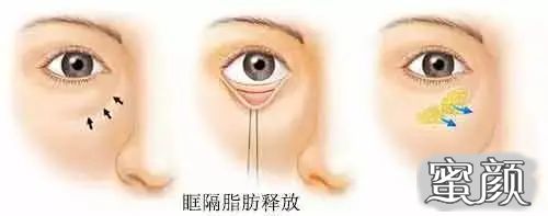 https://img.miyanlife.com/mnt/timg/210325/12424W119-7.jpg