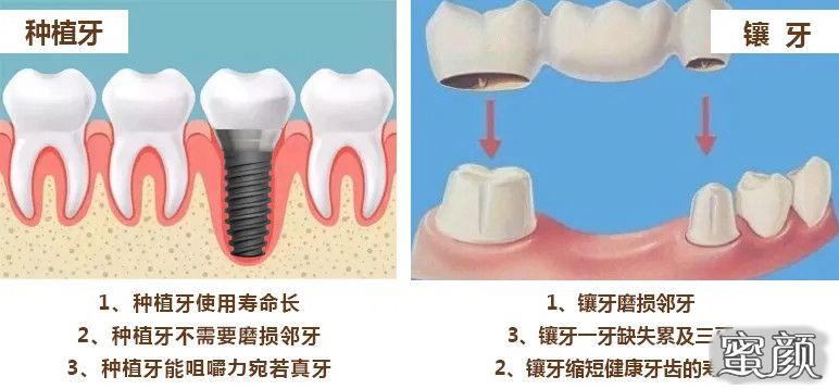 案例图片