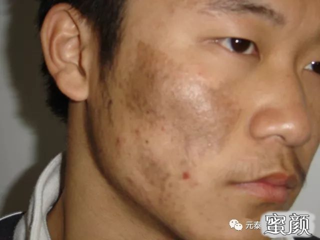 https://img.miyanlife.com/mnt/timg/210327/2149393016-6.jpg